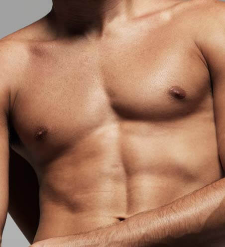 Gynecomastia before and after photos